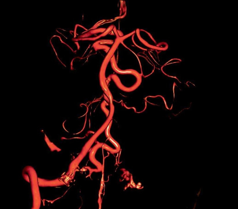 Giải phẫu mạch máu thần kinh (Neurovascular)