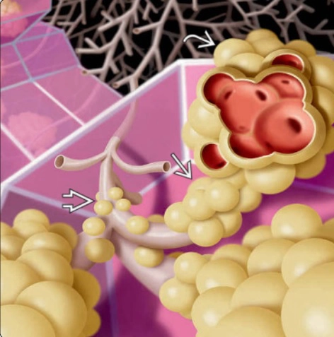 Các kiểu hình bệnh lý phổi