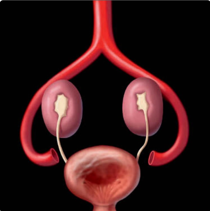 Tiết niệu Nhi (Pediatric Genitourinary)