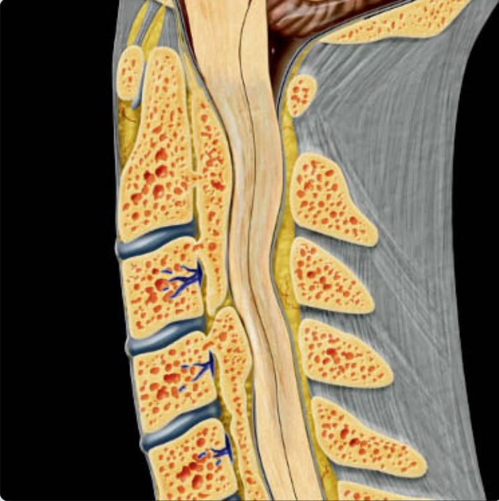 Bệnh lý cấu trúc cột sống (Hủy eo, Trượt, OPLL)