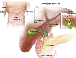 Xơ gan bẩm sinh (Congenital Hepatic Fibrosis - CHF)