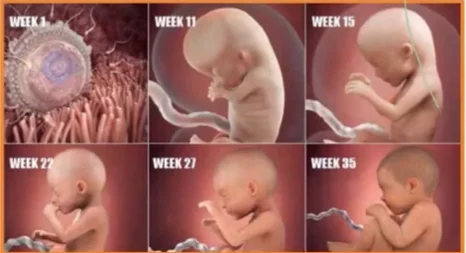 Sinh trắc học thai nhi (Fetal Biometry)