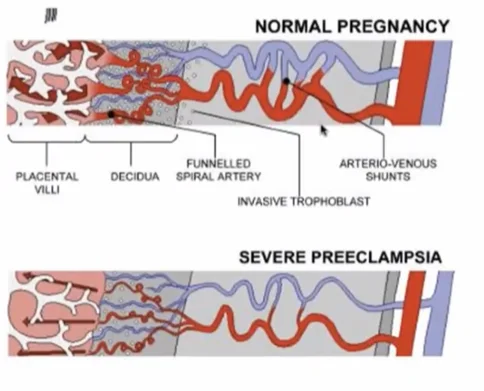 Thai chậm tăng trưởng trong tử cung (Fetal Growth Restriction - FGR)
