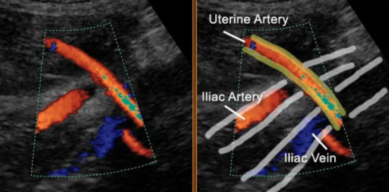 Doppler trong sản khoa