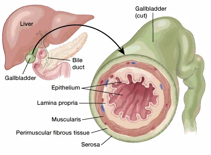 Phân loại giai đoạn ung thư túi mật (Gallbladder cancer staging)