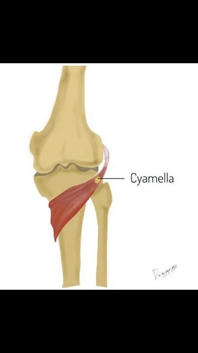 Xương vừng cơ khoeo khớp gối (Cyamella)
