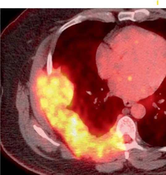 Thành ngực và cơ hoành