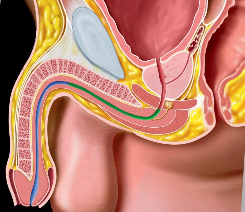 Niệu đạo/Dương vật