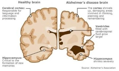 Chuyển hóa/thoái hóa di truyền