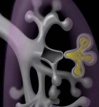 Bất thường phát triển bẩm sinh