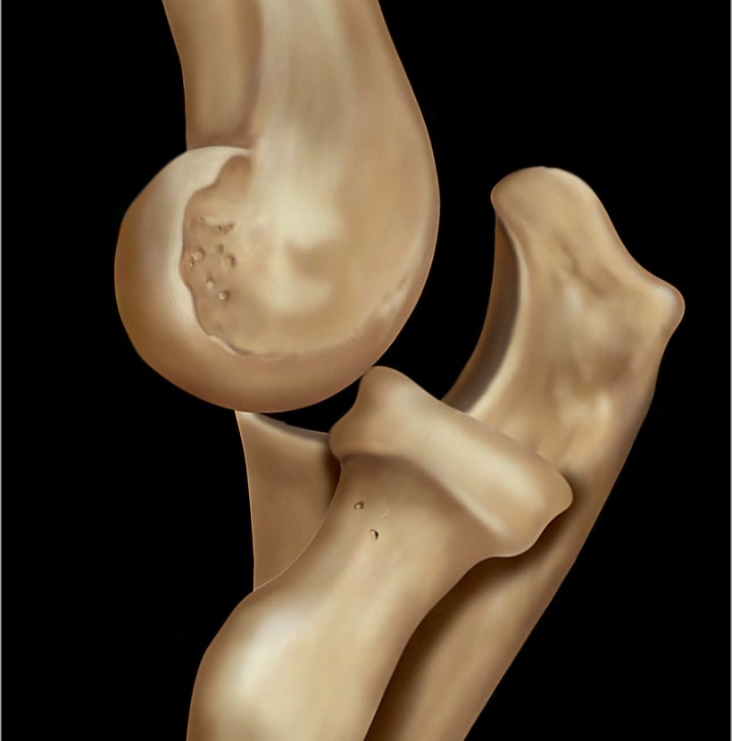 Khuỷu tay và cẳng tay