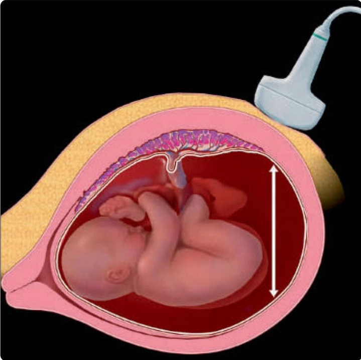 Tăng trưởng, sức khỏe thai nhi