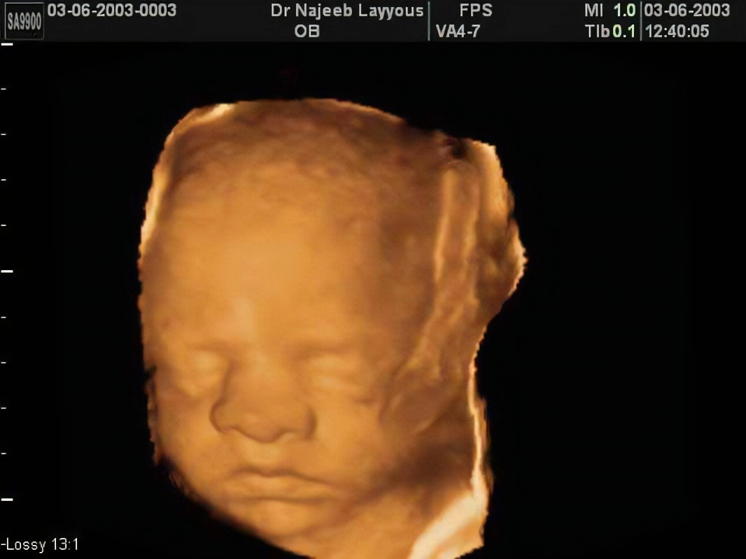 Mặt và cổ thai nhi