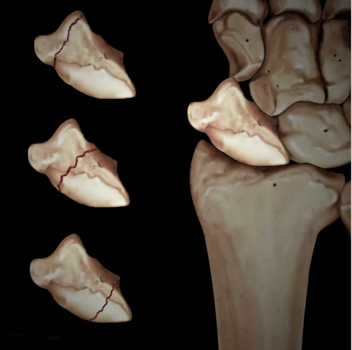 Cổ tay và bàn tay