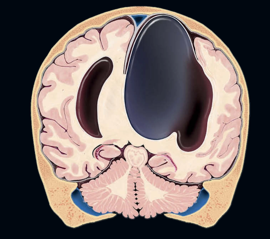 Thần kinh thai nhi