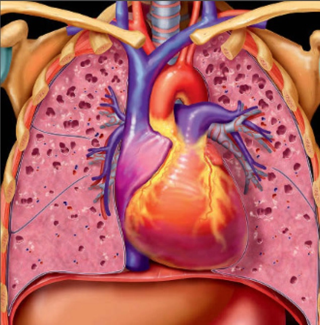 Bệnh phổi mô kẽ, lan tỏa và hít phải