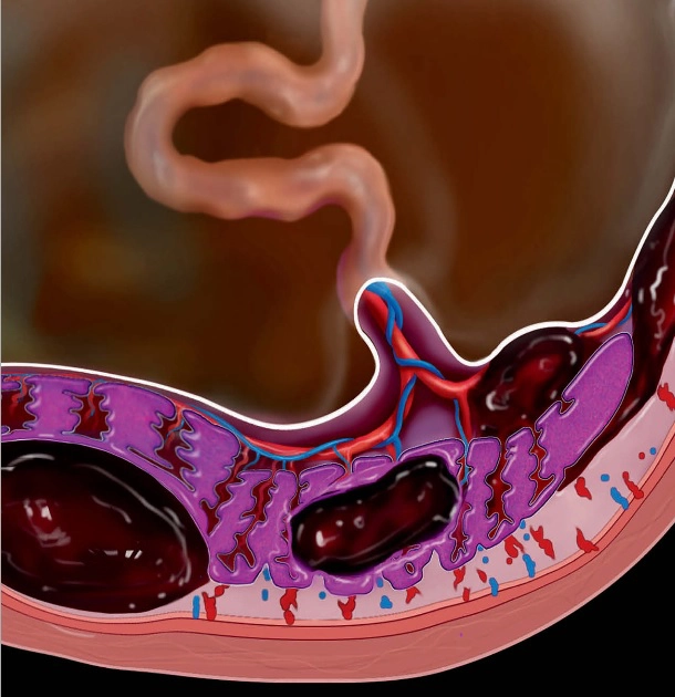 Bánh nhau, màng ối, dây rốn