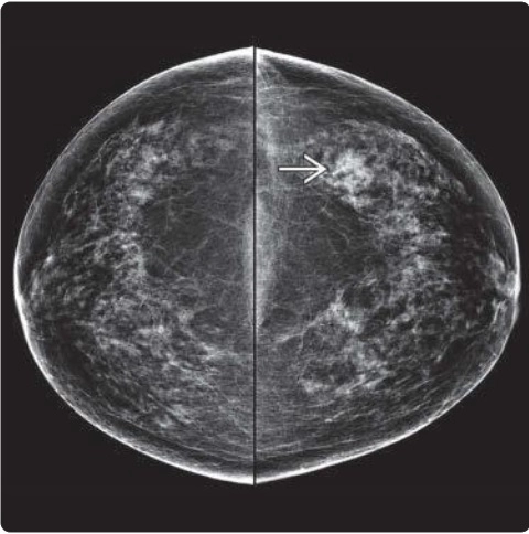 Tổn thương nguy cơ cao