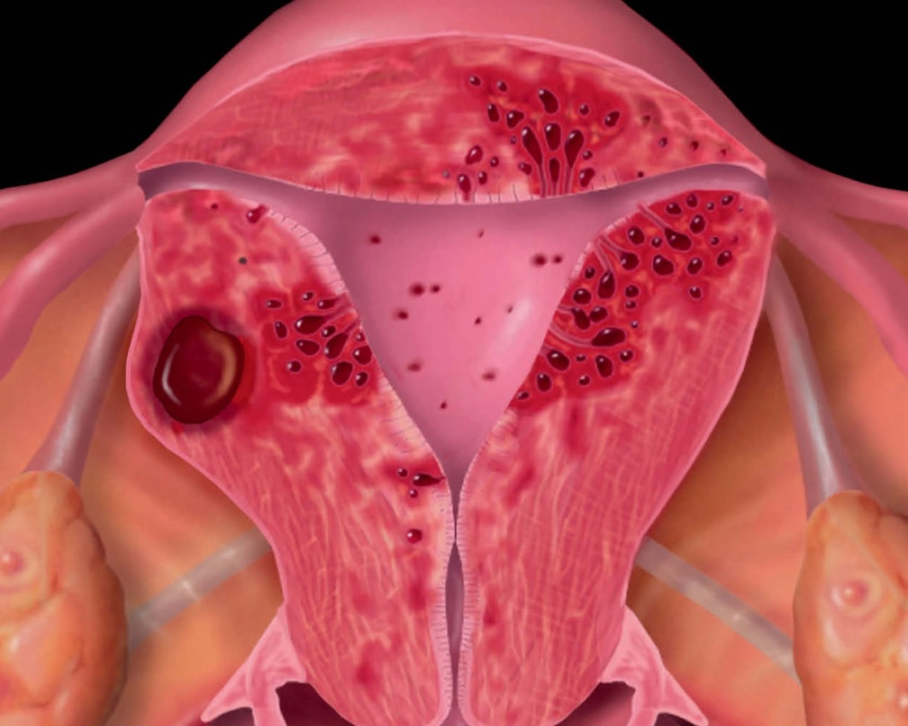 Bệnh lý mẹ trong thai kỳ