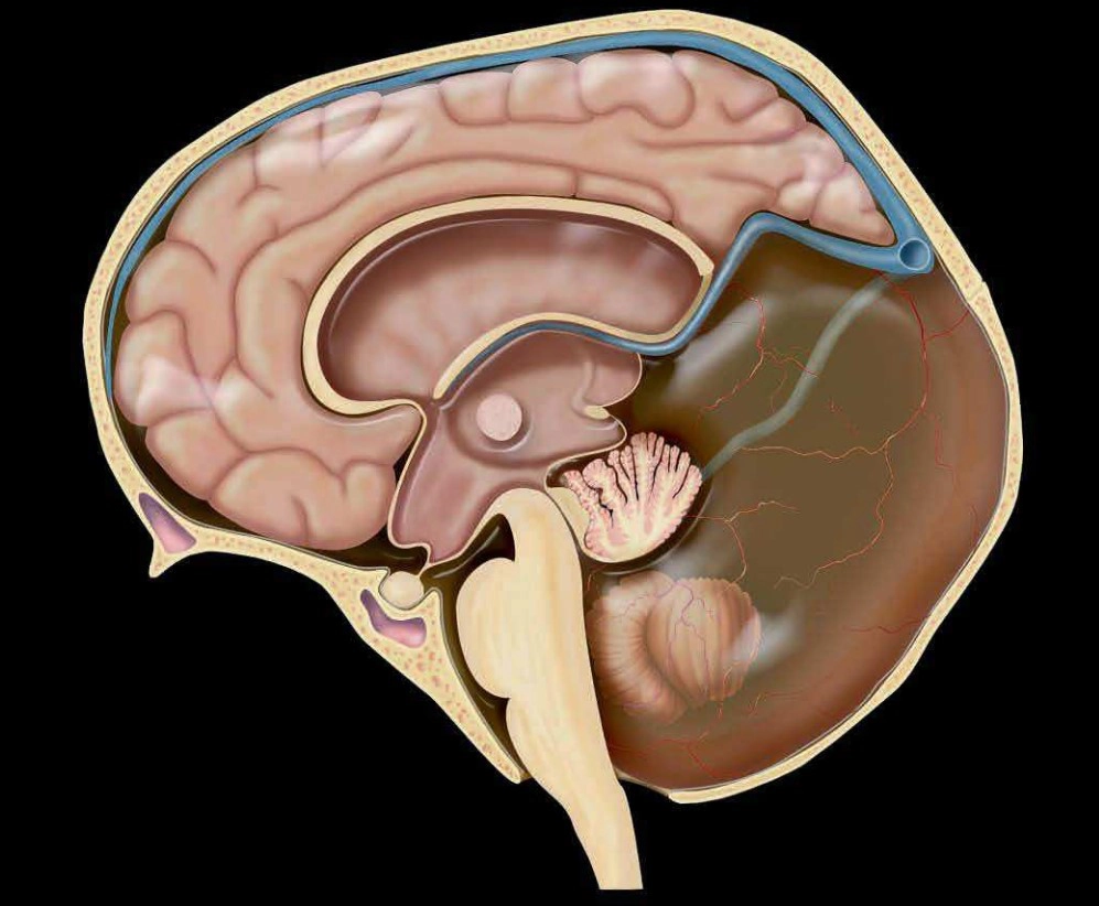 Bất thường bẩm sinh