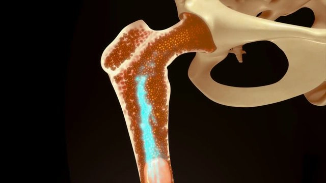 Bệnh lý tủy xương