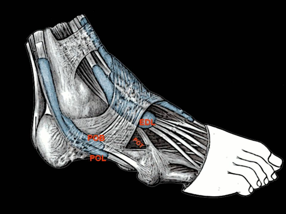 Các cơ mác phụ (Accessory peroneal muscles)