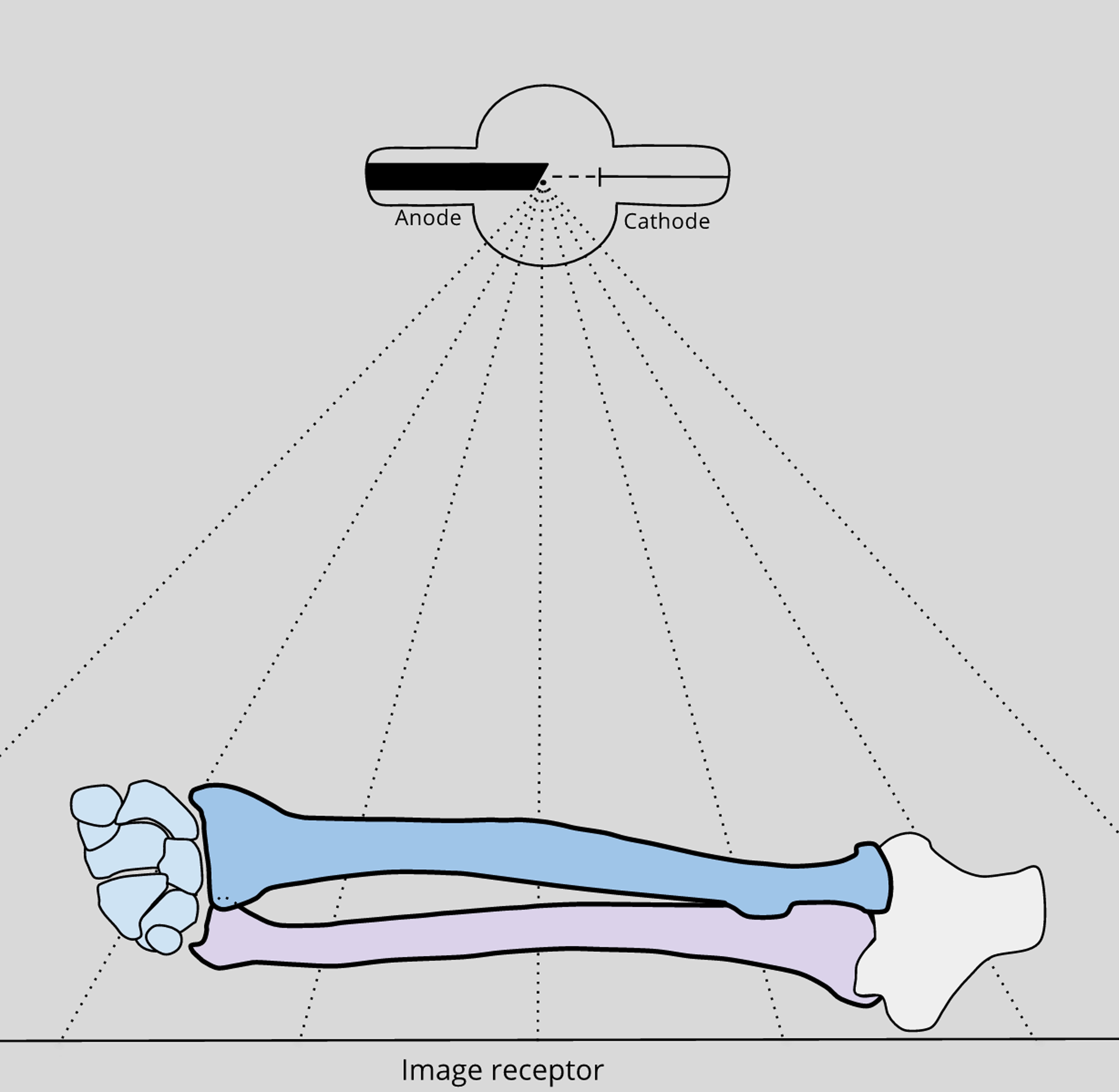 X Quang xương cẳng tay