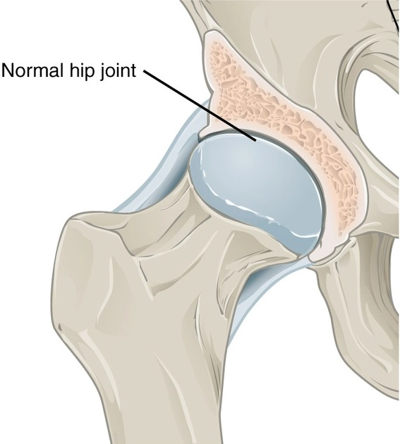 Thoái hóa khớp háng (Hip Osteoarthritis - Hip OA) 
