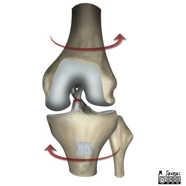 Rách dây chằng chéo trước ACL (Anterior cruciate ligament tear)