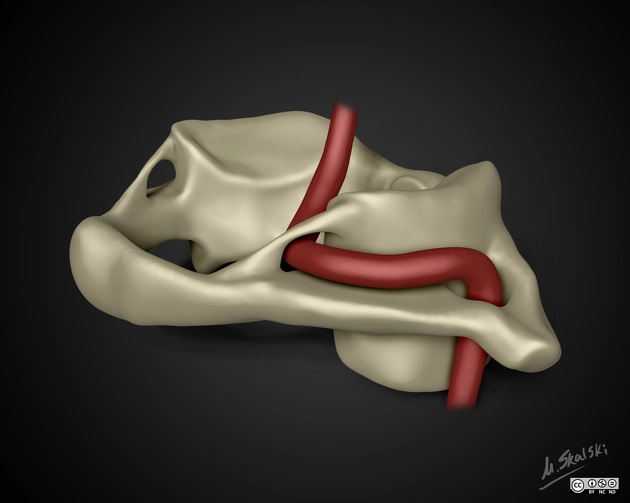 Lỗ cung sống (Arcuate foramen)