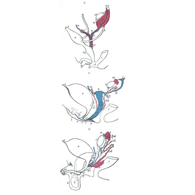 Dị dạng tử cung bẩm sinh/ Các bất thường ống Muller (Müllerian duct anomalies)