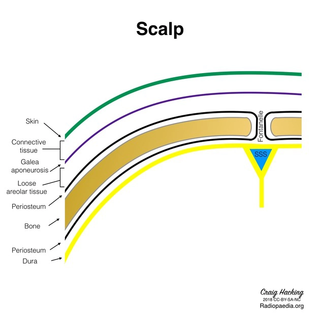 Bướu huyết thanh (Caput Succedaneum)