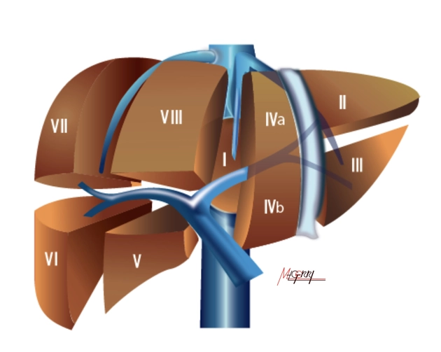 Giải phẫu phân thùy gan theo Couinaud (Couinaud classification of hepatic segments)