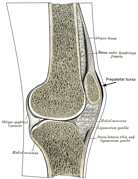 Viêm bao hoạt dịch dưới bánh chè nông (Superficial infrapatellar bursitis) 