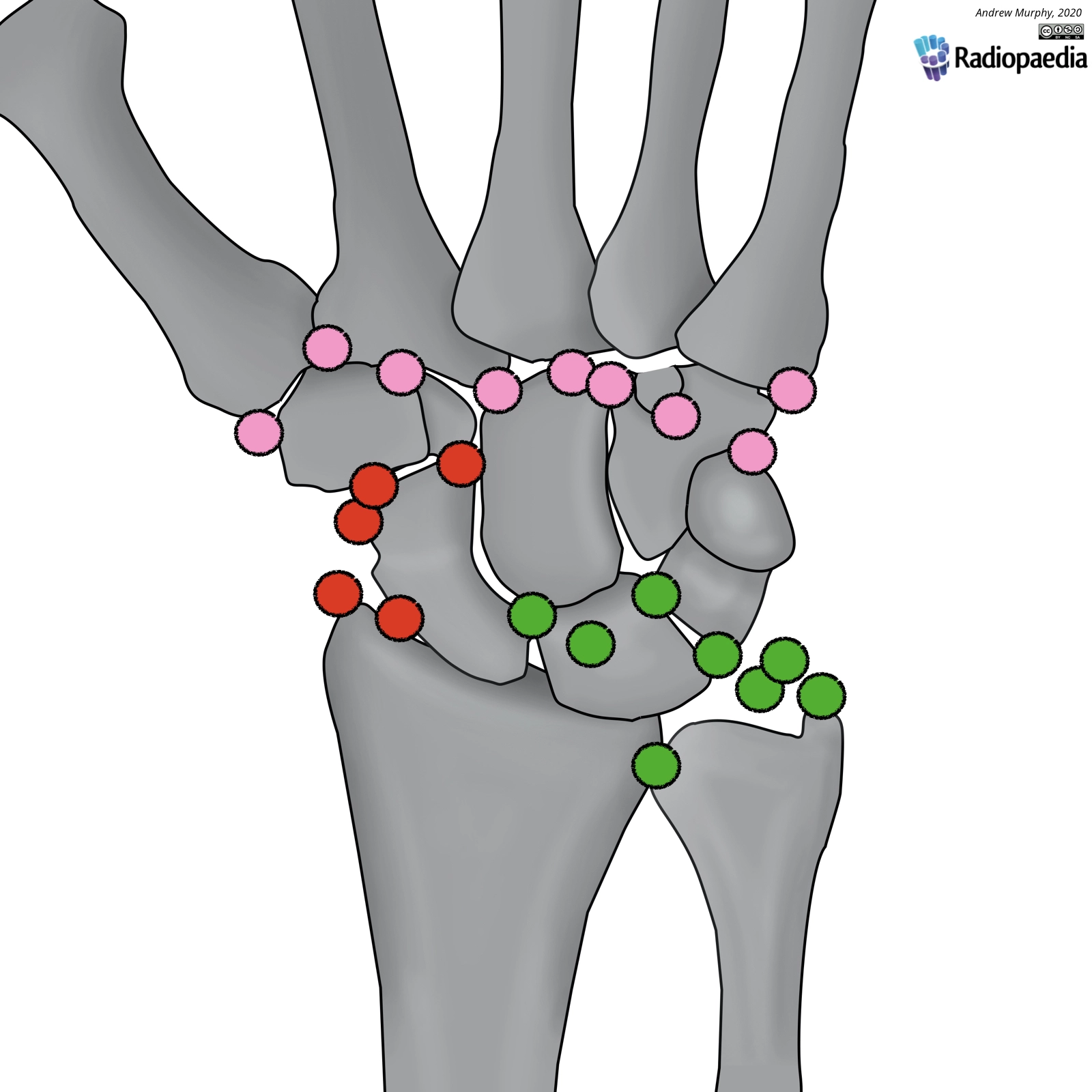 Các xương phụ vùng cổ tay (Accessory ossicles of the wrist)