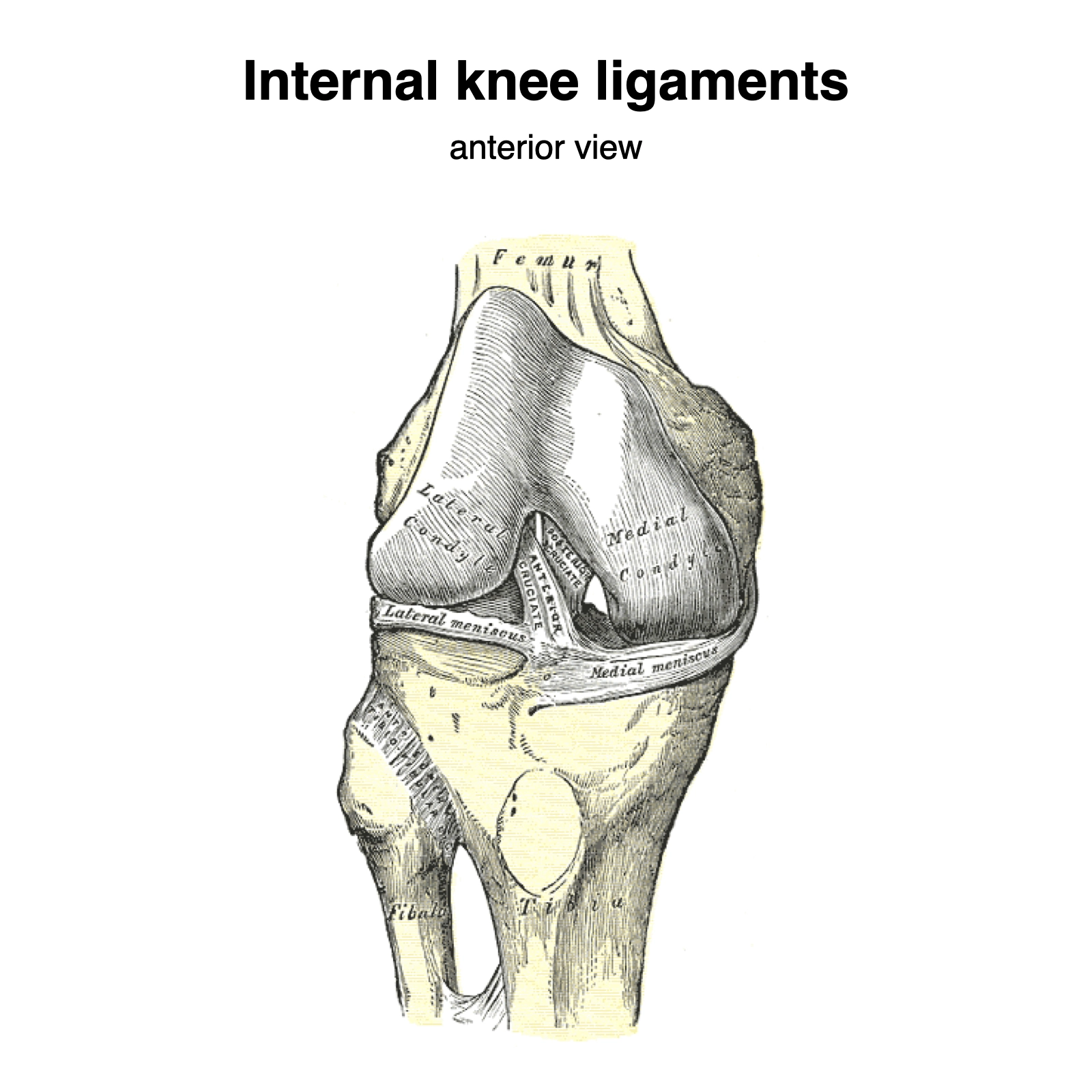 Biến thể Dây chằng sụn chêm - đùi ở gối (Meniscofemoral ligament - MFL))