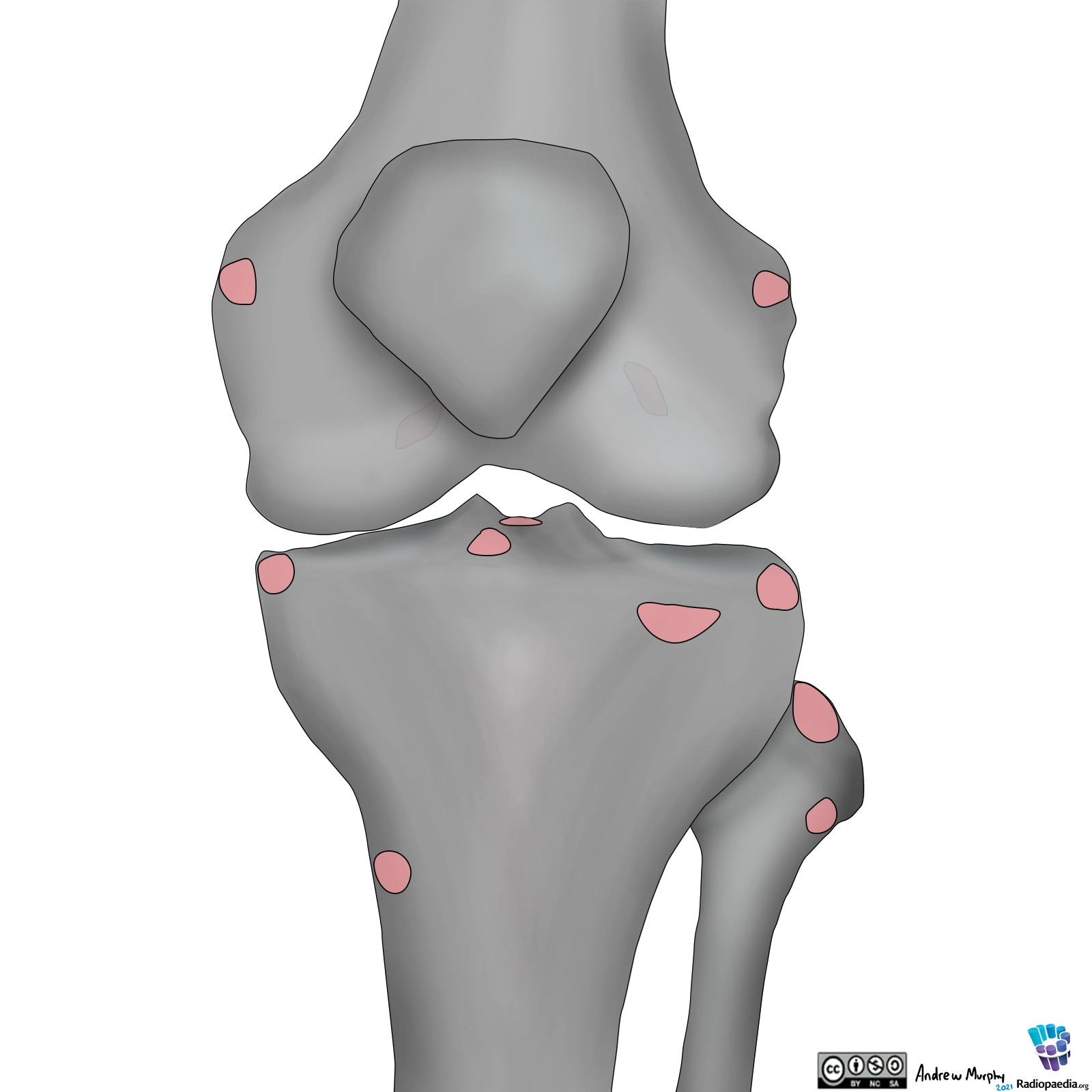 X quang khớp gối