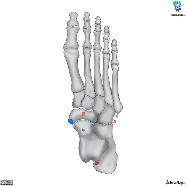 Xương phụ ở bàn chân (Accessory ossicles of the foot)