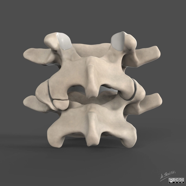 Xương phụ khớp liên mấu (Oppenheimer ossicle)