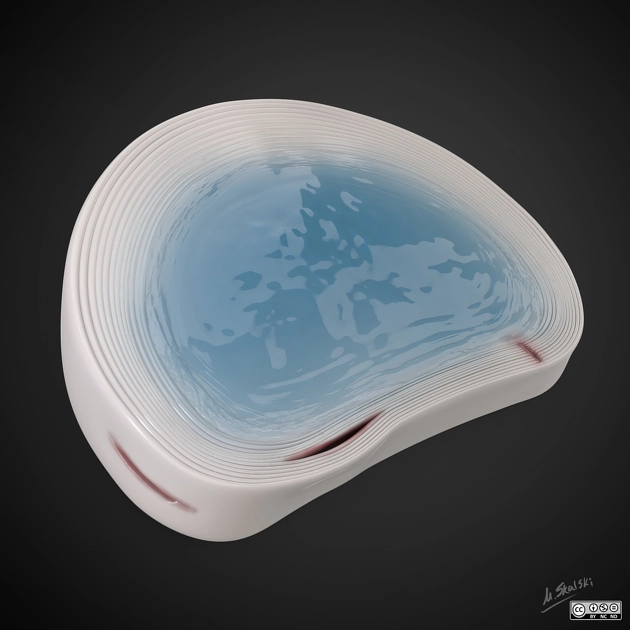 Rách vòng sợi (Annular fissure)