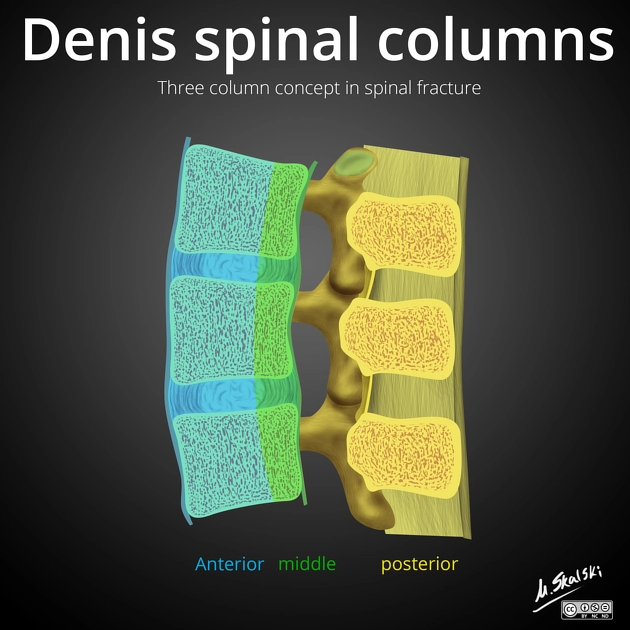 Khái niệm ba cột trong gãy đốt sống của Denis (Three column concept of spinal fractures)